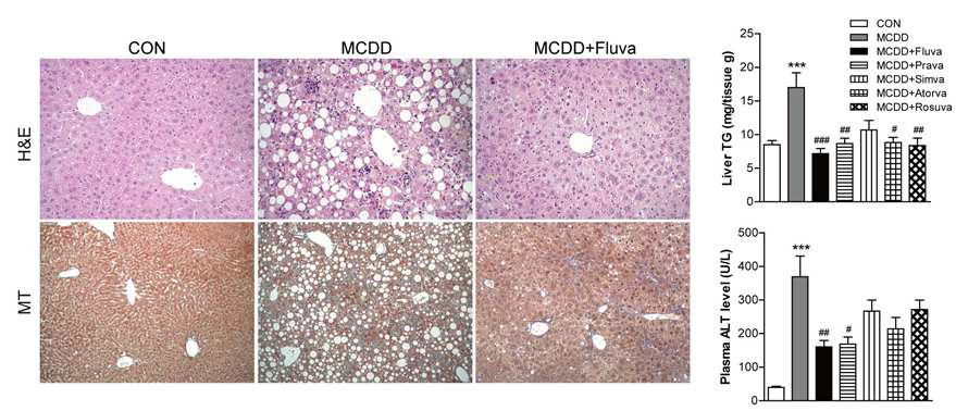 Statin에 의한 MCDD-induced steatohepatitis 예방효과