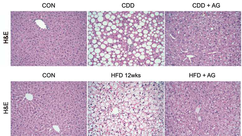 AG 처리 시 CDD와 HFD에 의한 지방간 호전 효과