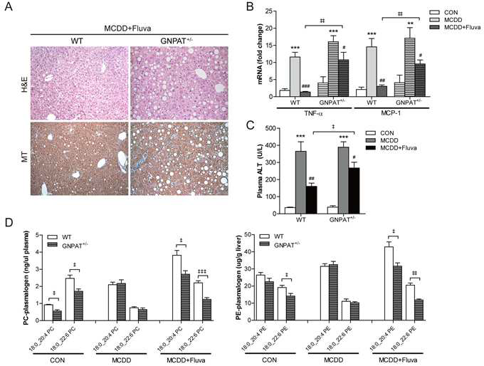 GNPAT+/- mice에서 MCDD에 의한 지방간염 악화