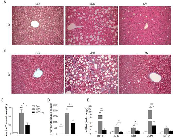 Myriocin에 의한 MCDD-induced steatohepatitis 예방효과