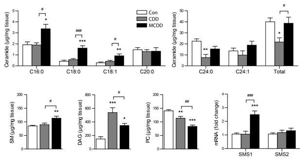 CDD와 MCDD에 의한 간 조직 lipid metabolite의 변화 및 SMS1 발현 변화