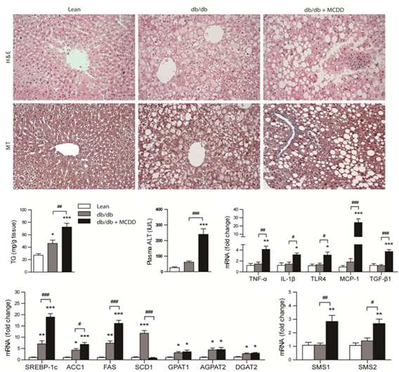 db/db mice의 MCDD-유도 지방간염 모델에서 SMS1의 발현 증가