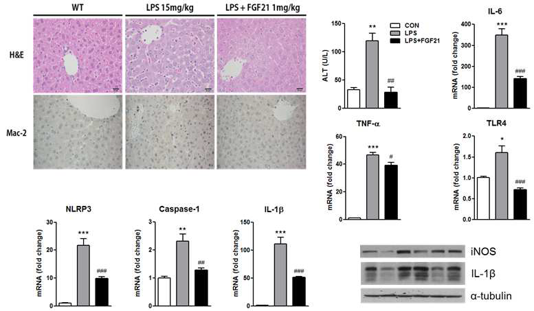 LPS와 FGF21 처리에 의한 간 조직소견 및 염증성 유전자 발현 변화