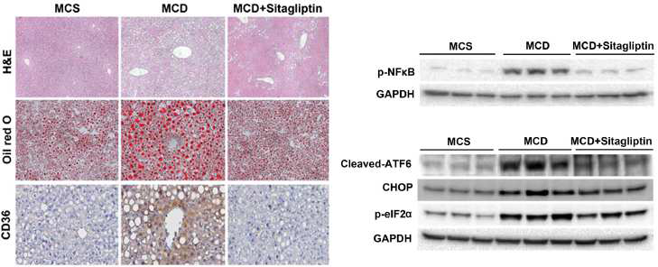 Sitagliptin에 의한 MCDD-유도 NASH 호전 및 ER stress 감소효과