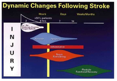 Timeline of Dynamic Changes Following a Stroke