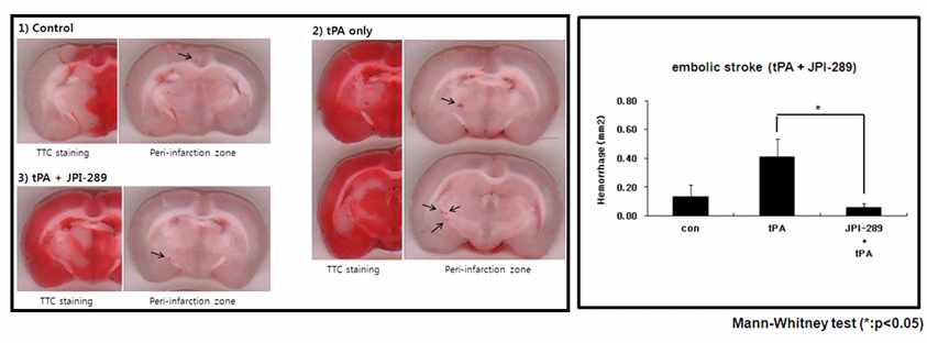 색전성 동물모델에서 JPI-289와 tPA 병용 투여에 의한 뇌출혈 감소 효능 평가