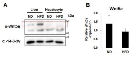 비만 간에서 Wnt5a 발현