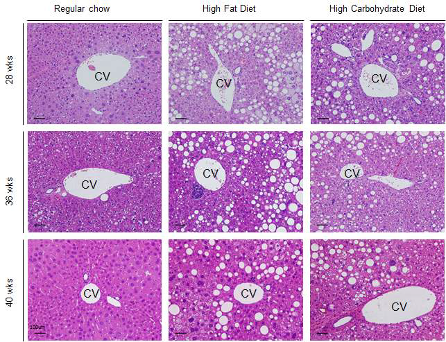 HBx 마우스의 고지방, 고탄수화물 식이섭취에 의한 간 조직 변화
