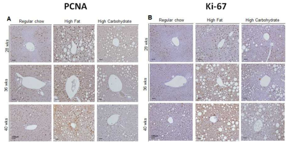 HBx 마우스의 고지방, 고탄수화물 식이섭취에 의한 간 조직 변화 (PCNA, Ki-67)