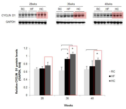 HBx 마우스의 고지방, 고탄수화물 식이섭취에 의한 cyclinD1발현 확인