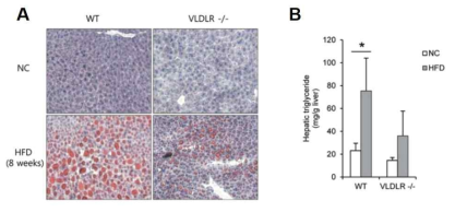 VLDLR KO에서 고지방 식이 섭취 후 지방간 조직염색