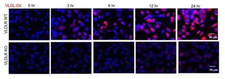 VLDLR KO 마우스의 대식세포에 형광표지 후 confocal 이미지