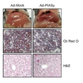 db/db 생쥐에서 PIASy를 과발현 후 지방간 관찰