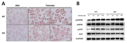 AHNAK KO의 primary 간세포에서 지방 축적과 AMPK pathway 단백질 확인