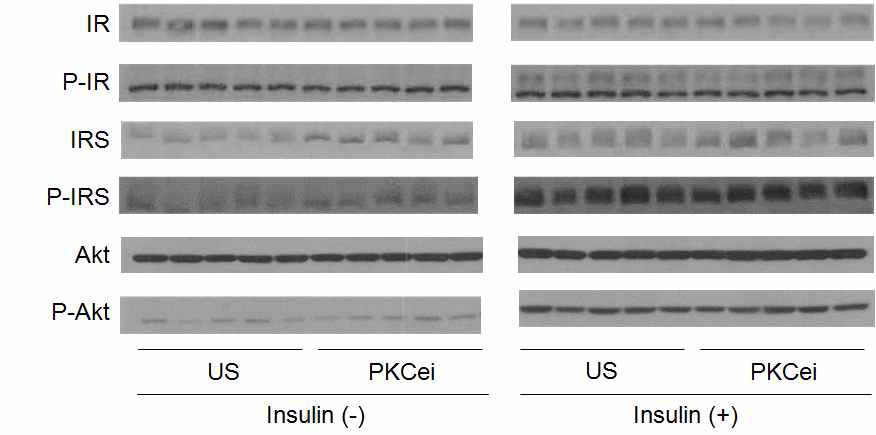 PKC epsilon knockdown에 따른 인슐린 신호전달계 변이 측정.