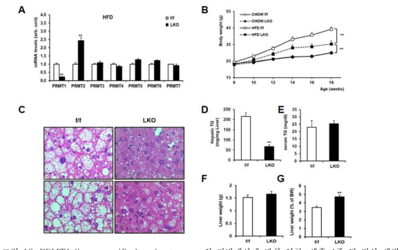 PRMT1 liver-specific knockout mouse의 지방대사에 관한 연구.