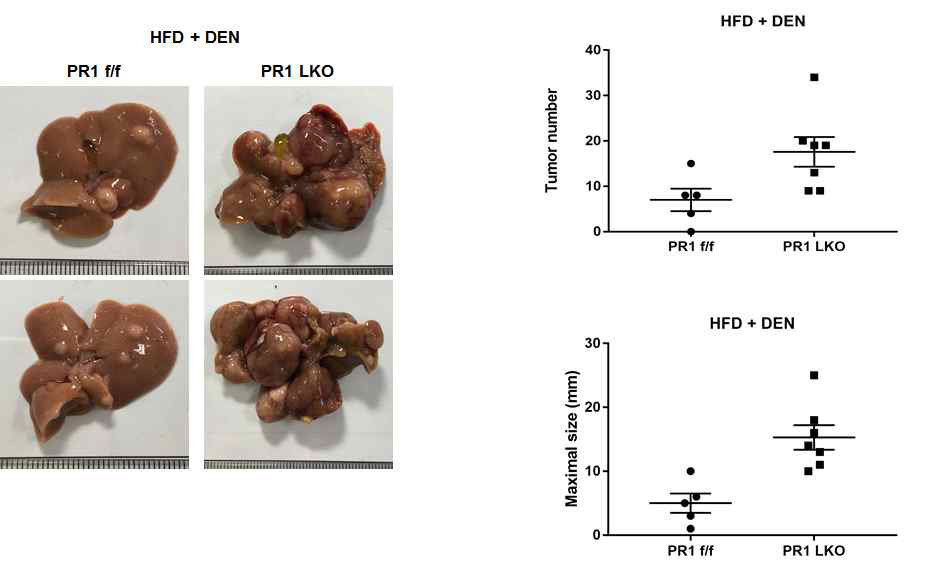 DEN 주입 후 HFD feeding에 따른 PRMT1의 간특이적 결손 영향. 종양 발생 여부, tumor size 및 maximal size를 측정함.