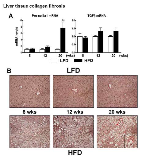 HFD 동물 모델에서 시기별 collagen fiborsis 변화