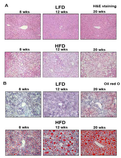 HFD 동물 모델에서 시기별 liver histology와 lipid droplet 변화