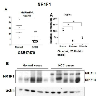 Normal 군과 NASH, HCC 환자 군 간의 NR1F1 mRNA, protein 차이