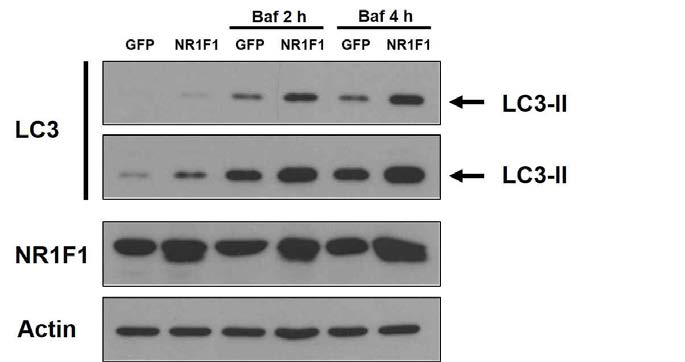 간세포에서 NR1F1 과발현에 의한 autophagy의 활성화