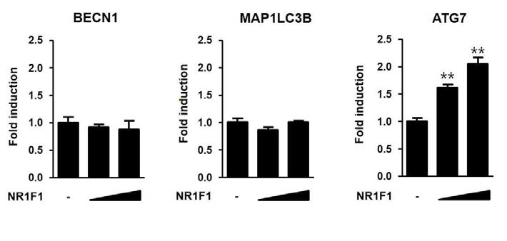 고지방식이 마우스에서 NR1F1의 과발현으로 인한 autophagy 관련 유전자의 전사 변화