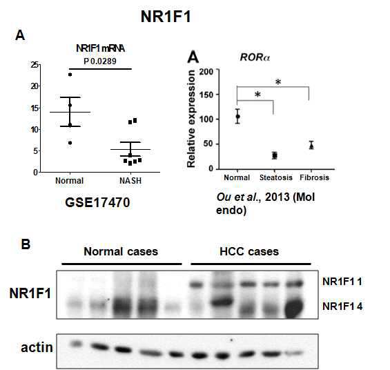 Normal 군과 NASH, HCC 환자 군 간의 NR1F1 mRNA, protein 차이