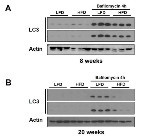 고지방식이가 간의 autophagy 활성에 미치는 영향