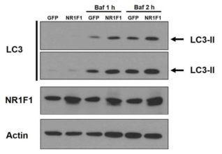 고지방식이 마우스에서 NR1F1의 과발현으로 인한 autophagy 활성 변화