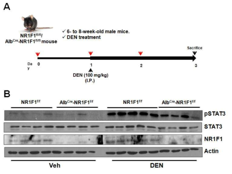 NR1F1 LKO mouse model에서 DEN-유도 STAT3 인산화 조절 효과