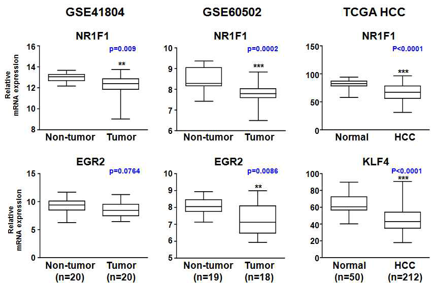 Non-tumor 군과 Tumor 군 및 Normal 군과 HCC 환자 군 간의 Kupffer cell polarity 결정인자 mRNA level 차이