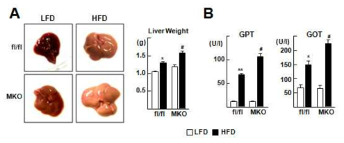 고지질식이로 유도된 질병 모델에서 대식세포 Nr1f1 KO 마우스의 간 무게 측정 및 혈액 생화학분석