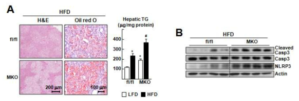 고지질식이로 유도된 질병 모델에서 대식세포 Nr1f1 KO 마우스의 지질 축적 및 사멸 stress 변화 분석