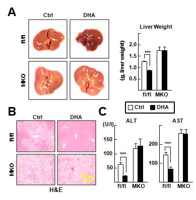 fl/fl 및 MKO 마우스에서 DHA의 NASH 질환 완화 효과