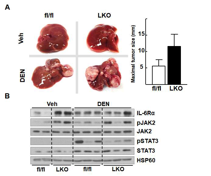 fl/fl 및 LKO 마우스에서 DEN 유도 간암 발생 관찰