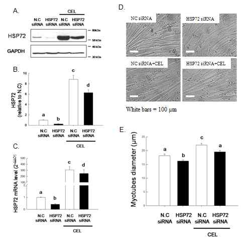 HSP72 발현 억제가 근세포 직경에 미치는 영향