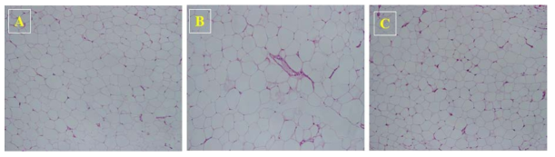 장수진흙버섯 폴리페놀 추출물 투여군의 복부 adipose 조직학적 검사(H & E staining).