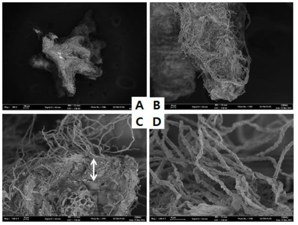 Morphological characteristics of P inus densiflora + Suillus granulatus mature ectomycorrhizas(A: whole ectomycorrhizas, B: ectomycorrhizas apex, C: mantle(↘), D: External hyphae).