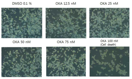 BE-APP/swe 세포에 okadaic acid를 각각 농도로 90분간 처리 하였을 때 세포모양변화