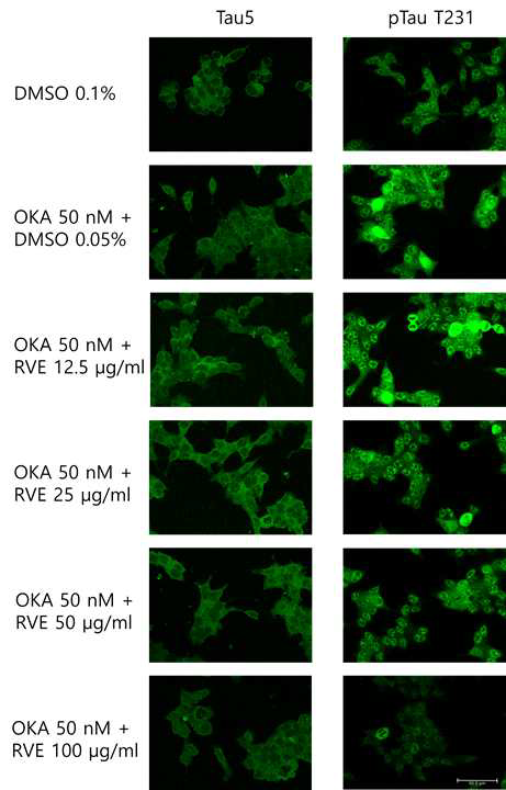 Okadaic acid 유도 in vitro SH-Sy5y 세포 알츠하이머 모델에서 옻나무 추출물이 okadaic acid 유도 tau 인산화에 미치는 영향