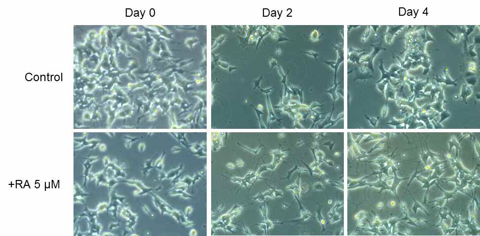 SH-Sy5y 세포의 분화 시간에 따른 세포 모양 변화