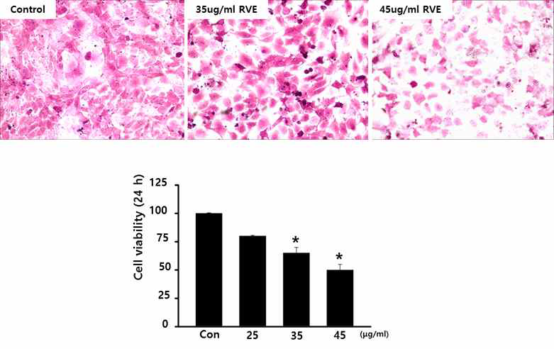 옻나무 추출물(RVE)의 전립선암세포(TRAMP-C2) 독성