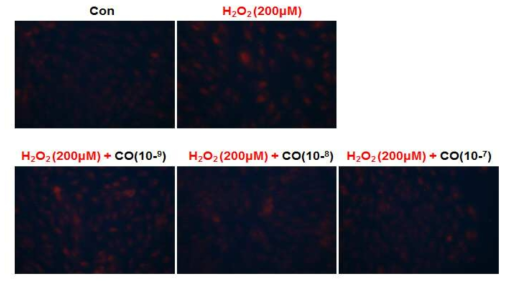 DHE 염색을 통한 편백 초임계 추출물의 ROS 생성 억제 효과 확인