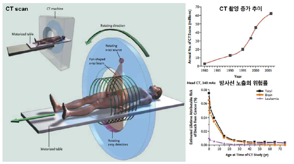 CT (Computed Tomography)의 개요와 CT 촬영 증가 추이 및 위험도