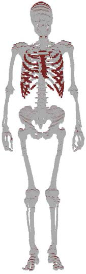 기존 ICRP 성인남성 표준팬텀 골격모델: 골피질(흰색), 해면질(붉은색)
