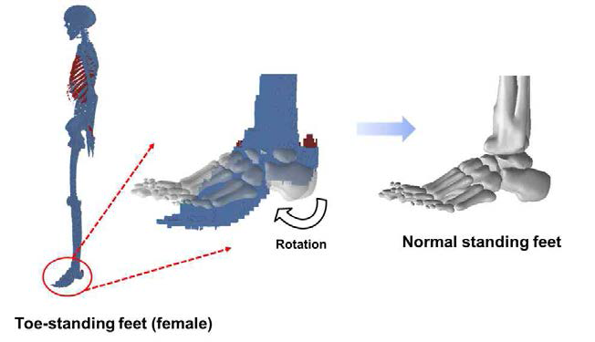 기존 ICRP 성인여성 표준팬텀의 발 뼈를 정상적으로 서있는 모양으로 조정하는 모습