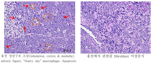 Wild type 마우스에서 발생한 thymic lymphoma 조직 분석 결과