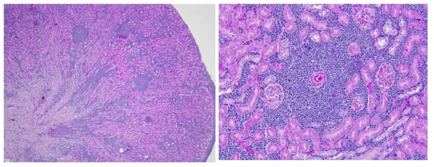 Thymic lymphoma가 관찰된 wild type 마우스에서 관찰된 신장