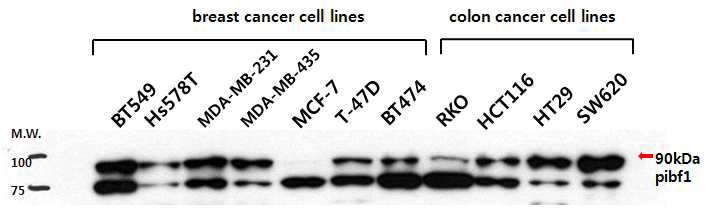 유방암 및 대장암 세포주에서 Pibf1 단백질 발현량 비교