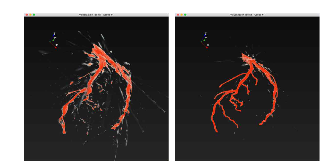 복원된 혈관 영상. 왼쪽) diastole->systole 변화중 측정된 영상으로 복원된 혈관영상 오른쪽) systole stage 혈관 복원 영상.